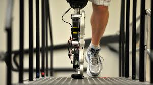 Science of Innovation: Bionic Limbs